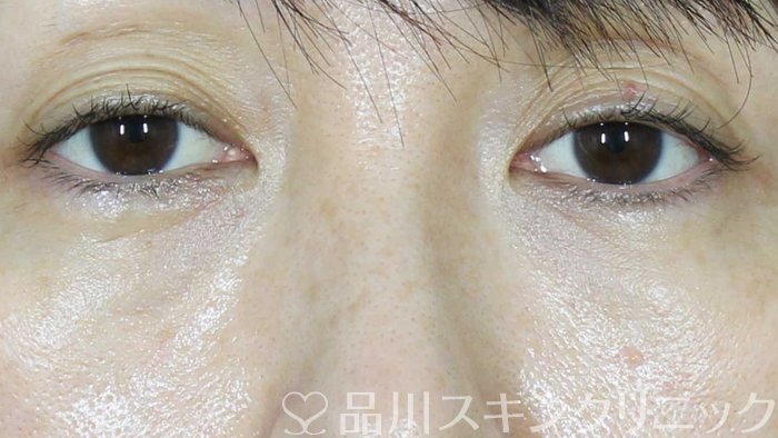 症例NO.71312のAFTER写真