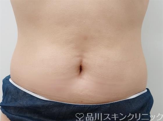 症例NO.28369のAFTER写真