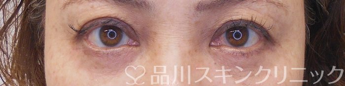 症例NO.70129のAFTER写真