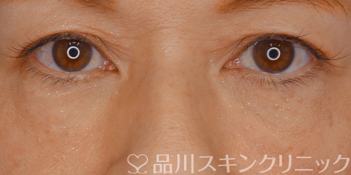 症例NO.71191のAFTER写真