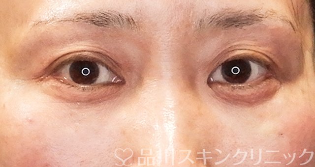 症例NO.63786のAFTER写真