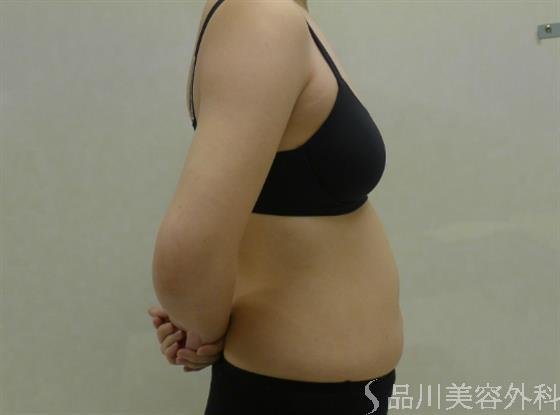 症例NO.34711のBEFORE写真