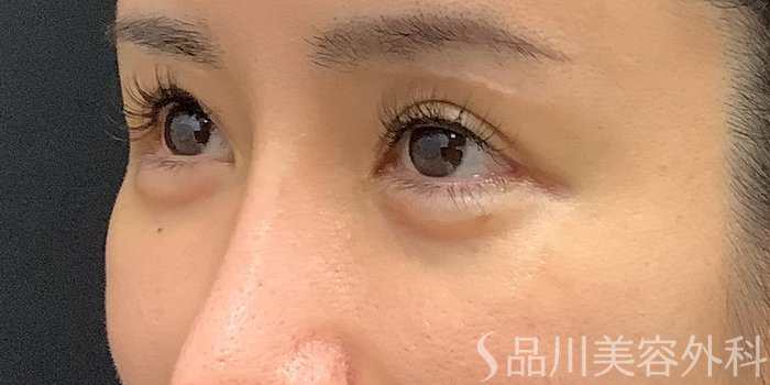 症例NO.67804のBEFORE写真