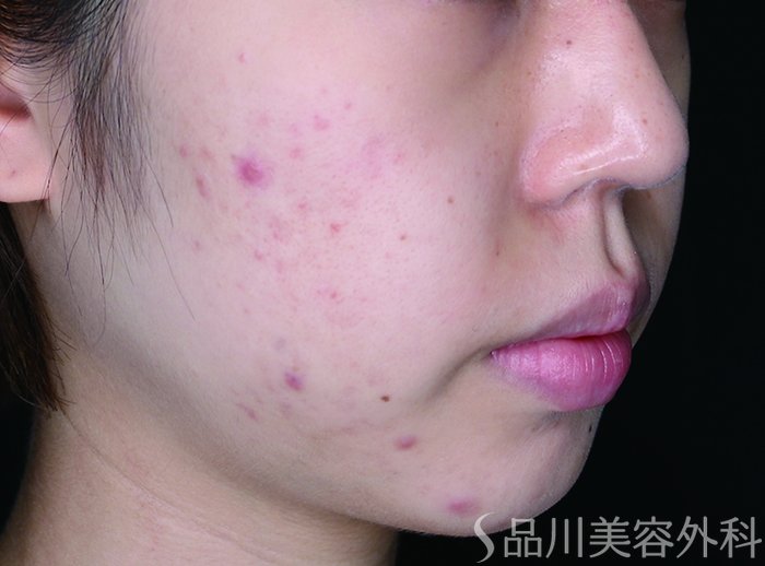 症例NO.73603のAFTER写真