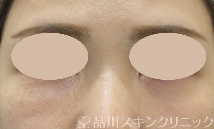 症例NO.73797のAFTER写真