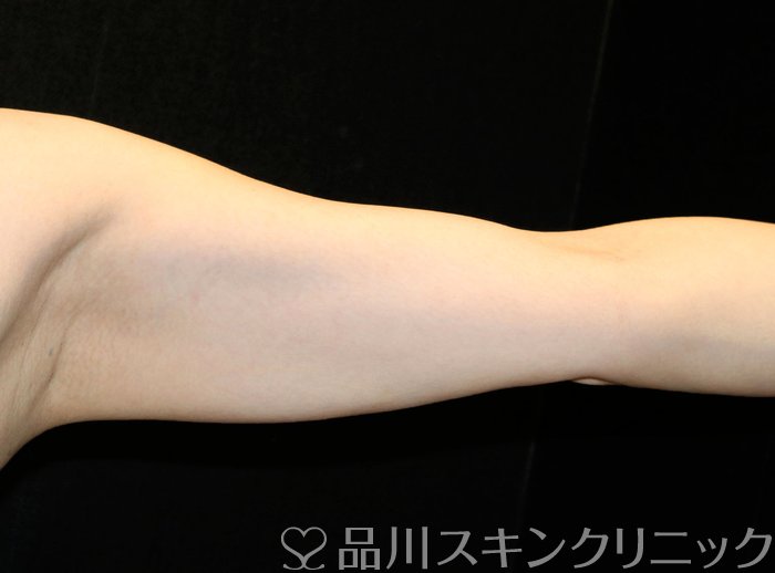 症例NO.73816のBEFORE写真