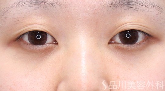 症例NO.70291のBEFORE写真