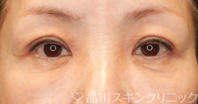 症例NO.65673のAFTER写真