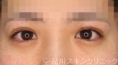 症例NO.63403のAFTER写真