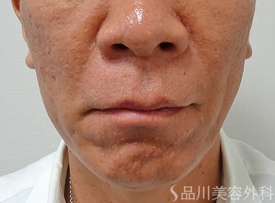 症例NO.73655のAFTER写真