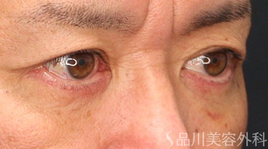 症例NO.69863のAFTER写真