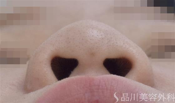 症例NO.48943のBEFORE写真