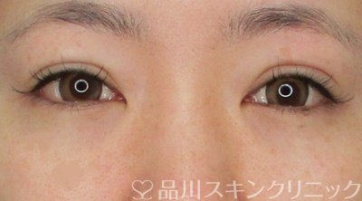 症例NO.65363のAFTER写真