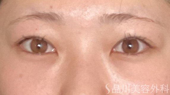 症例NO.65234のBEFORE写真