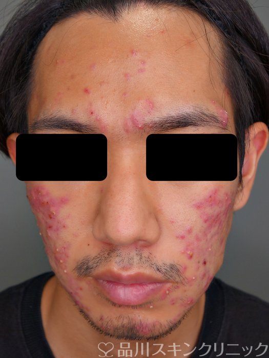 症例NO.73214のBEFORE写真