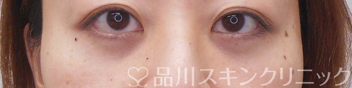 症例NO.71270のAFTER写真