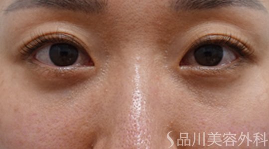 症例NO.71759のAFTER写真