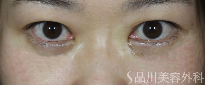 症例NO.72254のAFTER写真