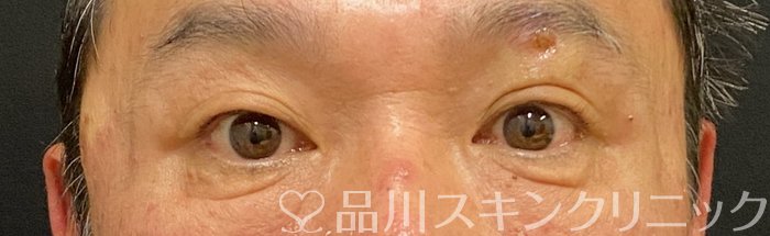 症例NO.74845のAFTER写真