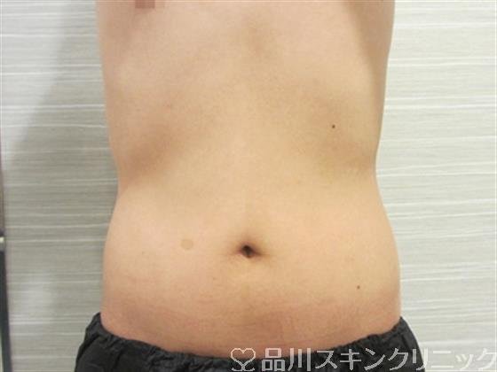 症例NO.34723のAFTER写真