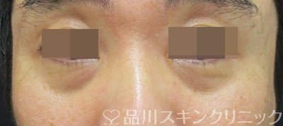 症例NO.70453のBEFORE写真