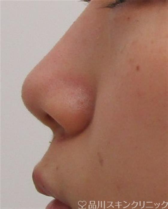 症例NO.43012のBEFORE写真