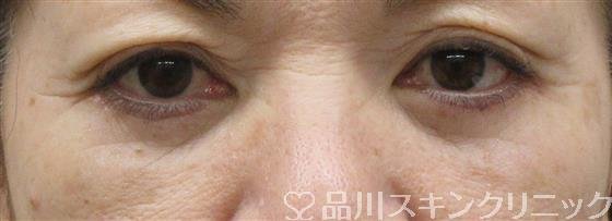 症例NO.60464のAFTER写真