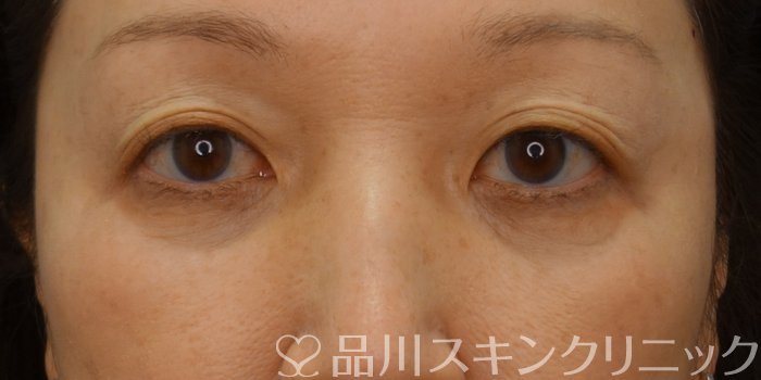 症例NO.74602のBEFORE写真