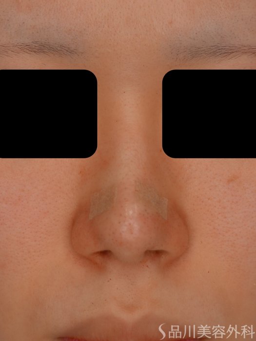 症例NO.73734のAFTER写真