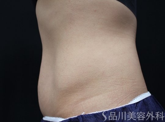 症例NO.75189のBEFORE写真