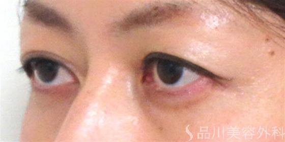 症例NO.20836のBEFORE写真