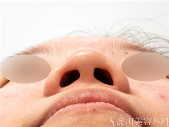 症例NO.54754のBEFORE写真