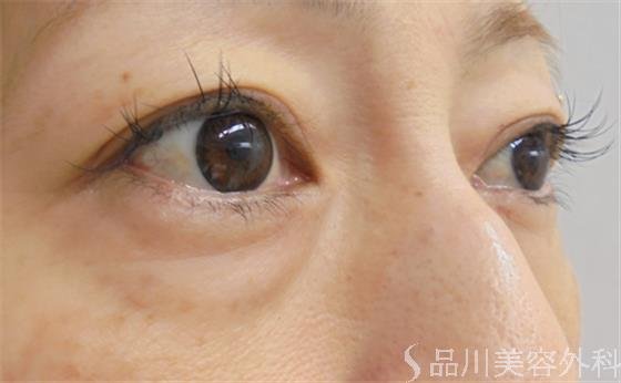 症例NO.24239のBEFORE写真