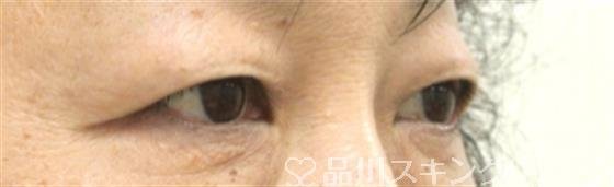 症例NO.29754のBEFORE写真