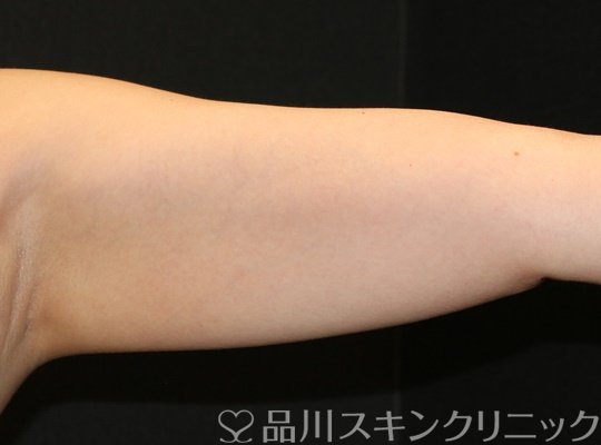 症例NO.75031のBEFORE写真