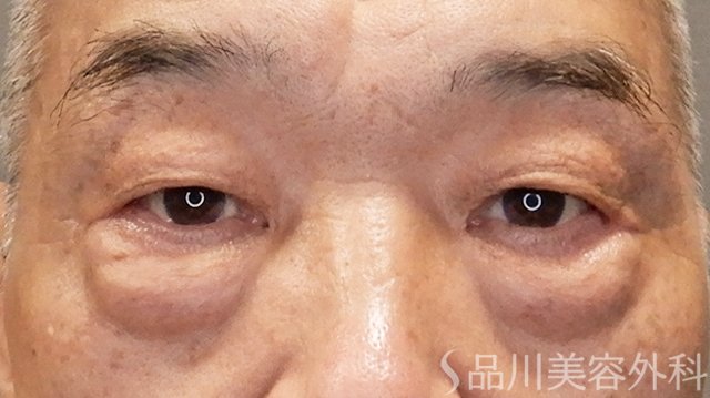 症例NO.75223のBEFORE写真