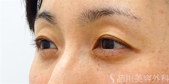 症例NO.53638のBEFORE写真