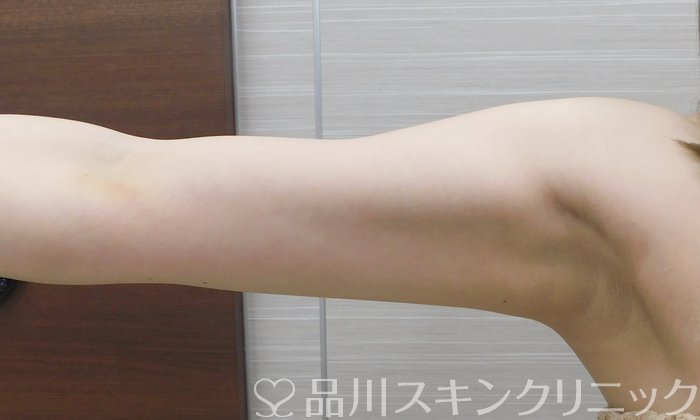 症例NO.67875のBEFORE写真