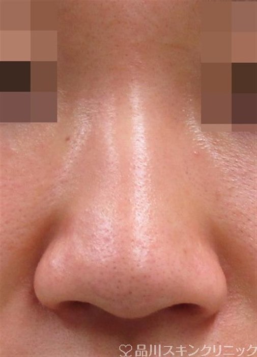 症例NO.34269のBEFORE写真