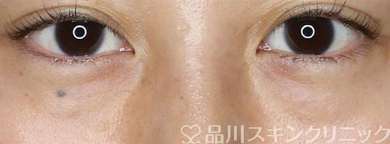 症例NO.59640のBEFORE写真