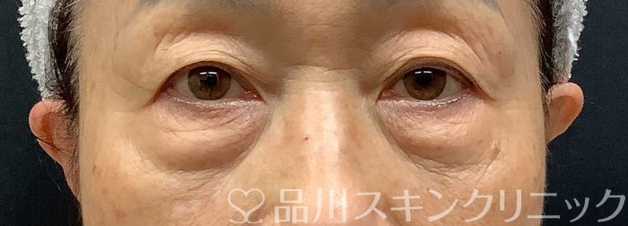 症例NO.69668のBEFORE写真