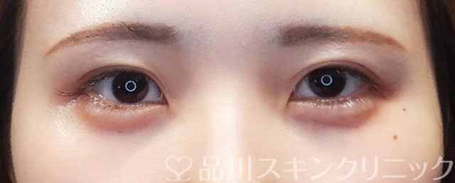 症例NO.73072のBEFORE写真