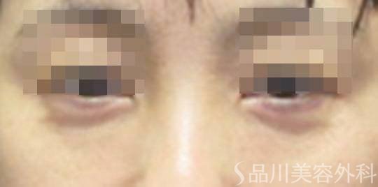 症例NO.73253のAFTER写真