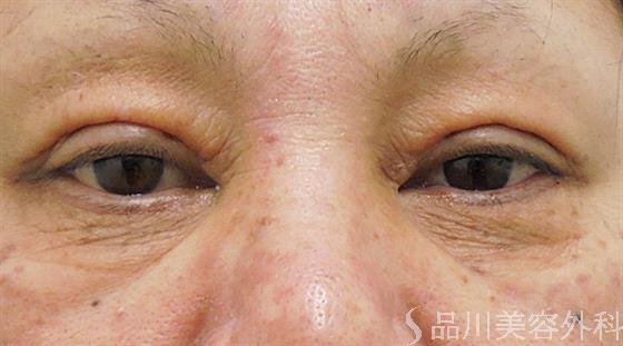 症例NO.30262のAFTER写真