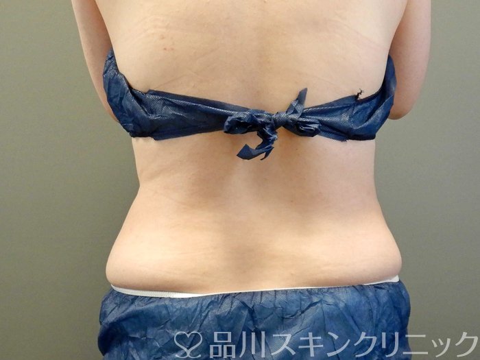 症例NO.65954のBEFORE写真