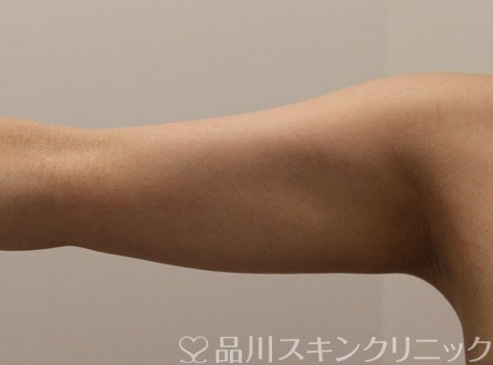 症例NO.71754のBEFORE写真