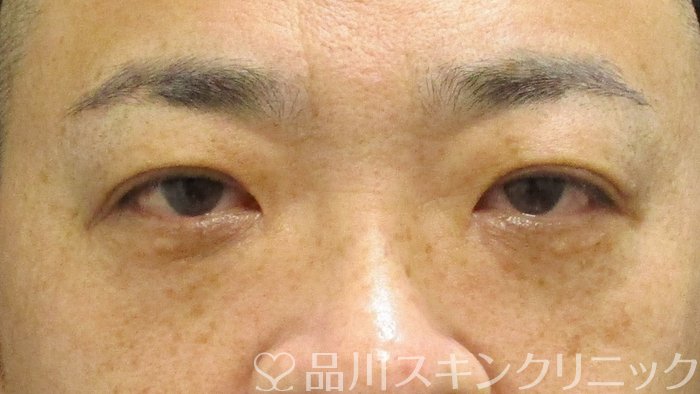 症例NO.73768のAFTER写真