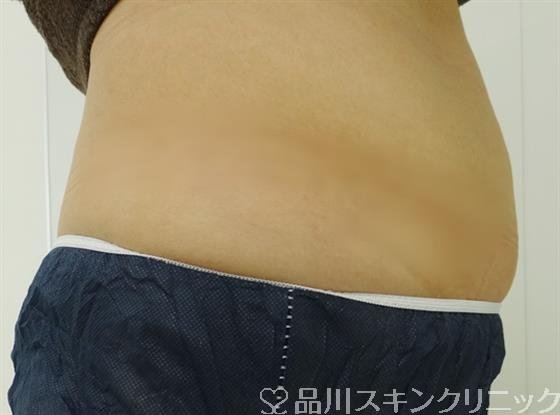 症例NO.31753のBEFORE写真