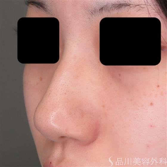 症例NO.50190のBEFORE写真