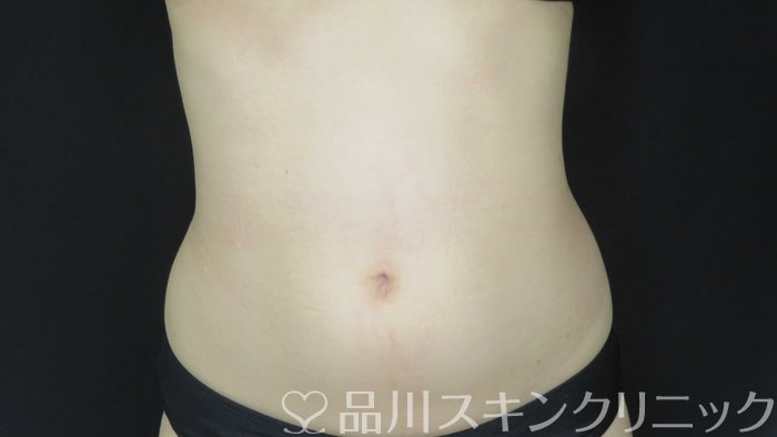 症例NO.72097のBEFORE写真